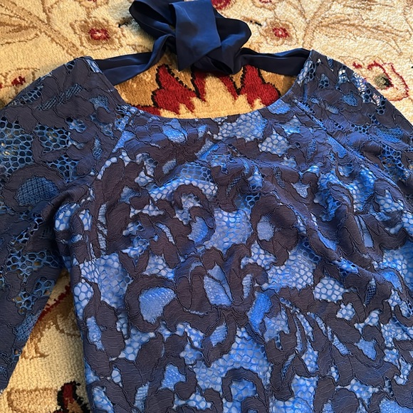 Lily Pulitzer Lace Dress - Picture 2 of 9